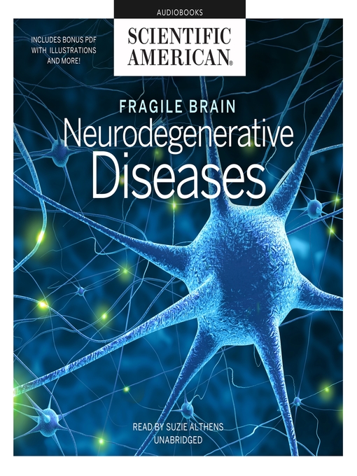 Title details for Fragile Brain by Scientific American - Wait list